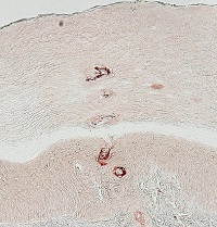 KLK14 | Kallikrein 14 in the group Antibodies for Human/Animal / Human Proteins / Other Human proteins at Agrisera AB (Antibodies for research) (AS06 101)
